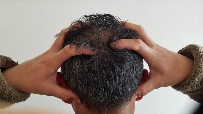 頭皮マッサージが発毛因子に働きかける事が証明されたことを解説