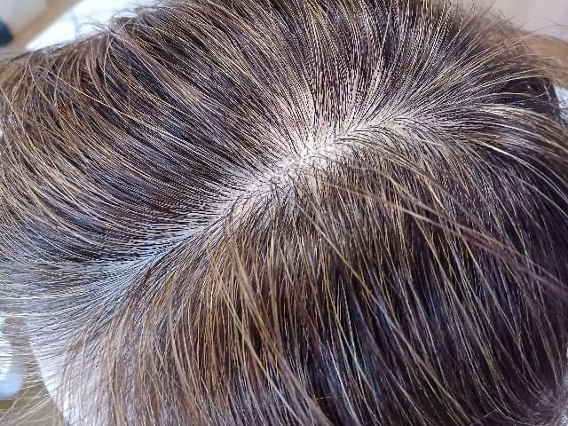 ヘアバースサプリメントを5ヶ月使用後の分け目～頭頂部。髪がボリュームアップしてきた感想