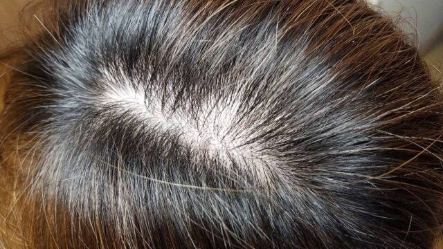 ヘアバースを6カ月飲んだ髪の毛の状態