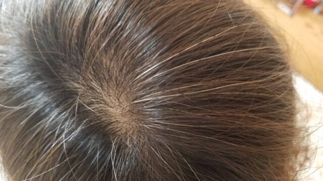 【口コミ】怪しいは本当？ヘアバースサプリの真相を徹底解明