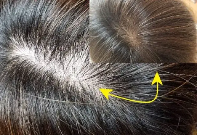 ヘアバースサプリメントを6ヶ月試したビフォーアフター