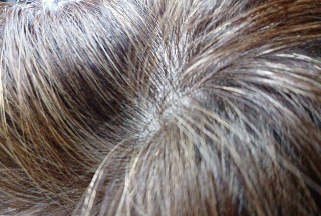 ヘアバースを6ヶ月飲み続けて改善した分け目