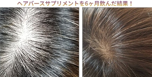 【口コミ】ヘアバース（ラミナスCYP）は効果なし？サプリを6ヶ月試した真相を徹底解明