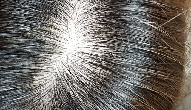 ヘアバースサプリメントを使用1～2ヶ月目の感想