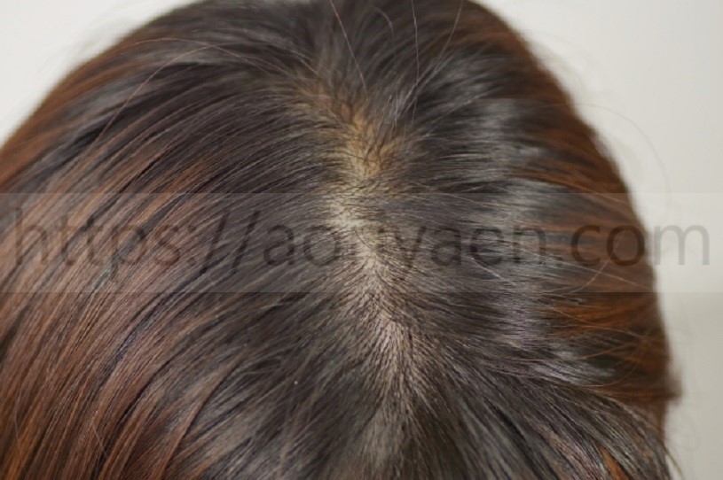 Haruシャンプー口コミを解析 黒髪スカルプの効果評判を暴露 あきブログ ヤエン釣り情報サイト