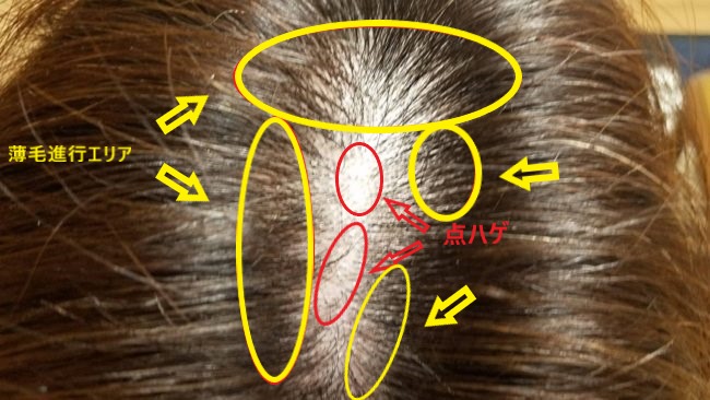 ミューノアージュの口コミ 効果と本当の育毛剤の評判を徹底調査 あきブログ ヤエン釣り情報サイト