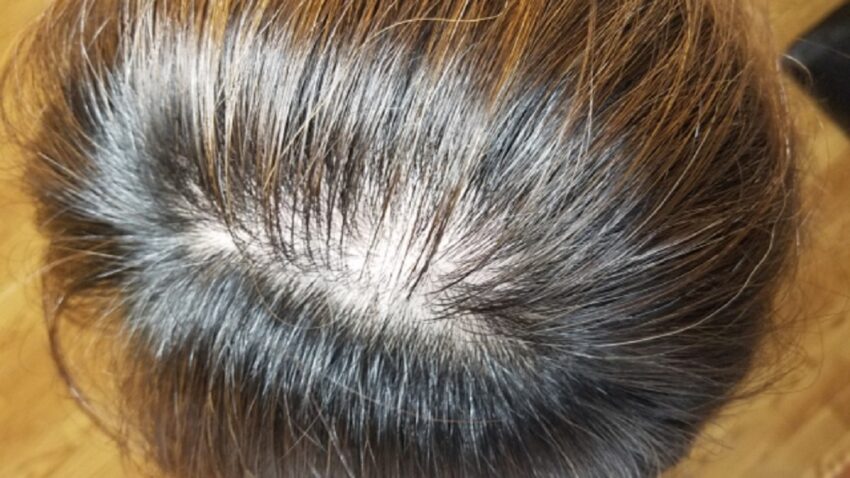 サプリメントに効果がなし?ヘアバースを体験してみた