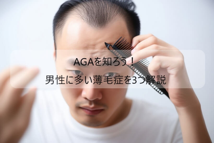 AGAを知ろう！男性に多い薄毛症を3つ解説