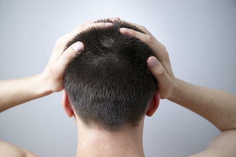 男性が薄毛になる原因と対策を解説