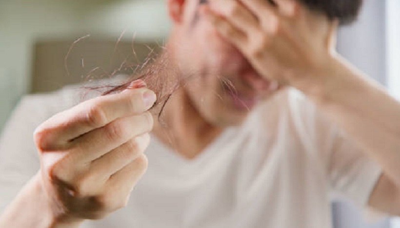 育毛剤の効果が期待できる男性の脱毛症を解説