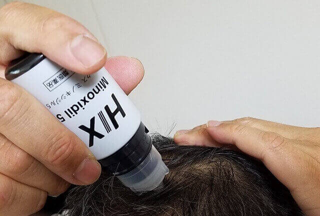 【4ヶ月体験談】ヒックスミノキシジル5の口コミは本当？効果・副作用・使い方を徹底検証