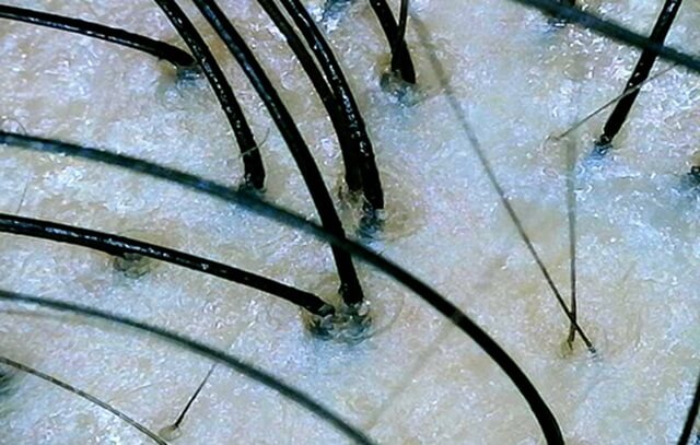 【口コミ】効果なし？ヒックス スカルプシャンプーを調べてみたら…