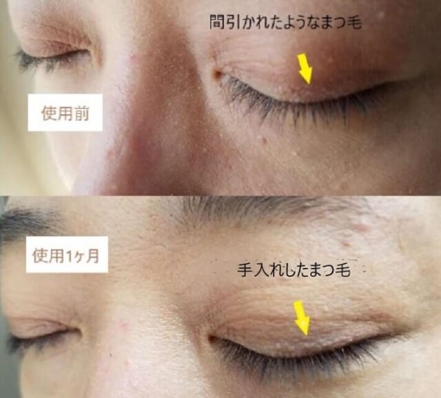 口コミ】ビオルチアまつ毛美容液 アイラッシュセラムの効果を徹底解説