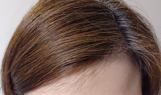 【レビュー】ラミナス育毛剤を40代女性が3ヶ月使って感じた効果