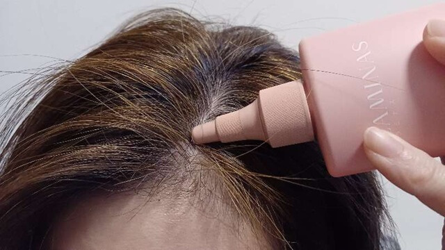 ラミナス育毛剤使い始めの生え際（1ヶ月目）