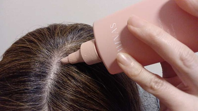 ラミナス育毛剤使用2ヶ月目の生え際