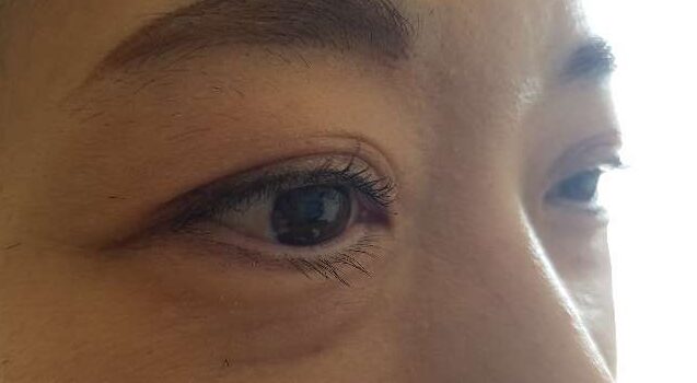 ラシックユープラスを1ヶ月使ってみた施工後のまつ毛
