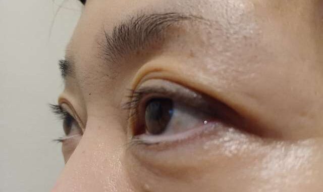 ラシックユーまつ毛美容液を使用中に斜め前から見た状態