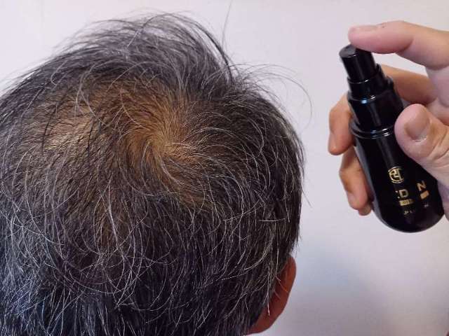 リデンを使用している画像（1か月継続）