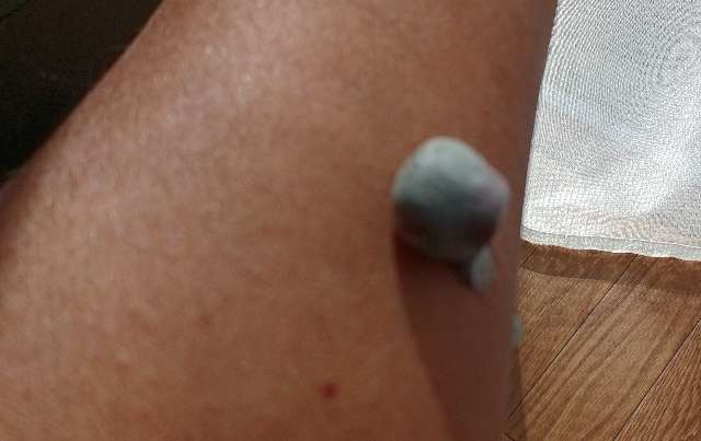 ビーリス白髪染めを腕の内側に塗り、パッチテストをする