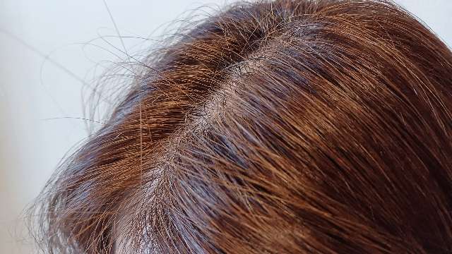 ビーリスのライトブラウンで白髪染めした左側の分け目