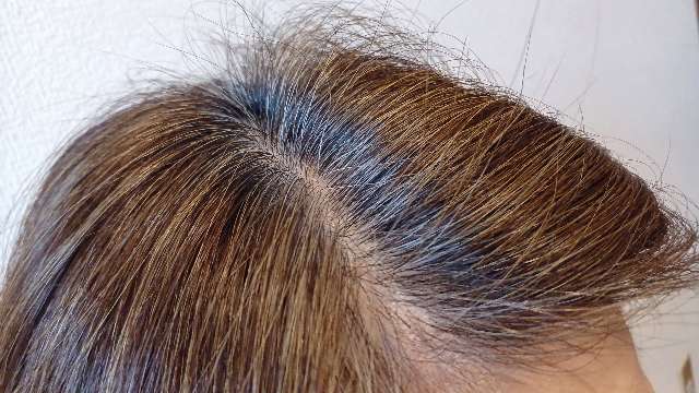 ビーリス白髪染め（ライトブラウン）の使用前（ビフォー）右側の分け目部分