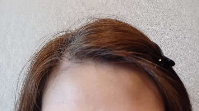 ビーリスのライトブラウンで白髪染め3週間後（生え際）