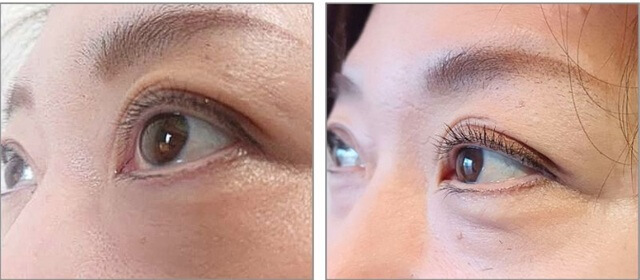 【2ヶ月ガチ検証】本当に伸びる？スカルプDプレミアムの口コミを毛髪診断士が評価