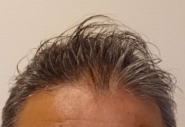 【実体験】50代男性がharu育毛剤を試してみた効果を本音レビュー